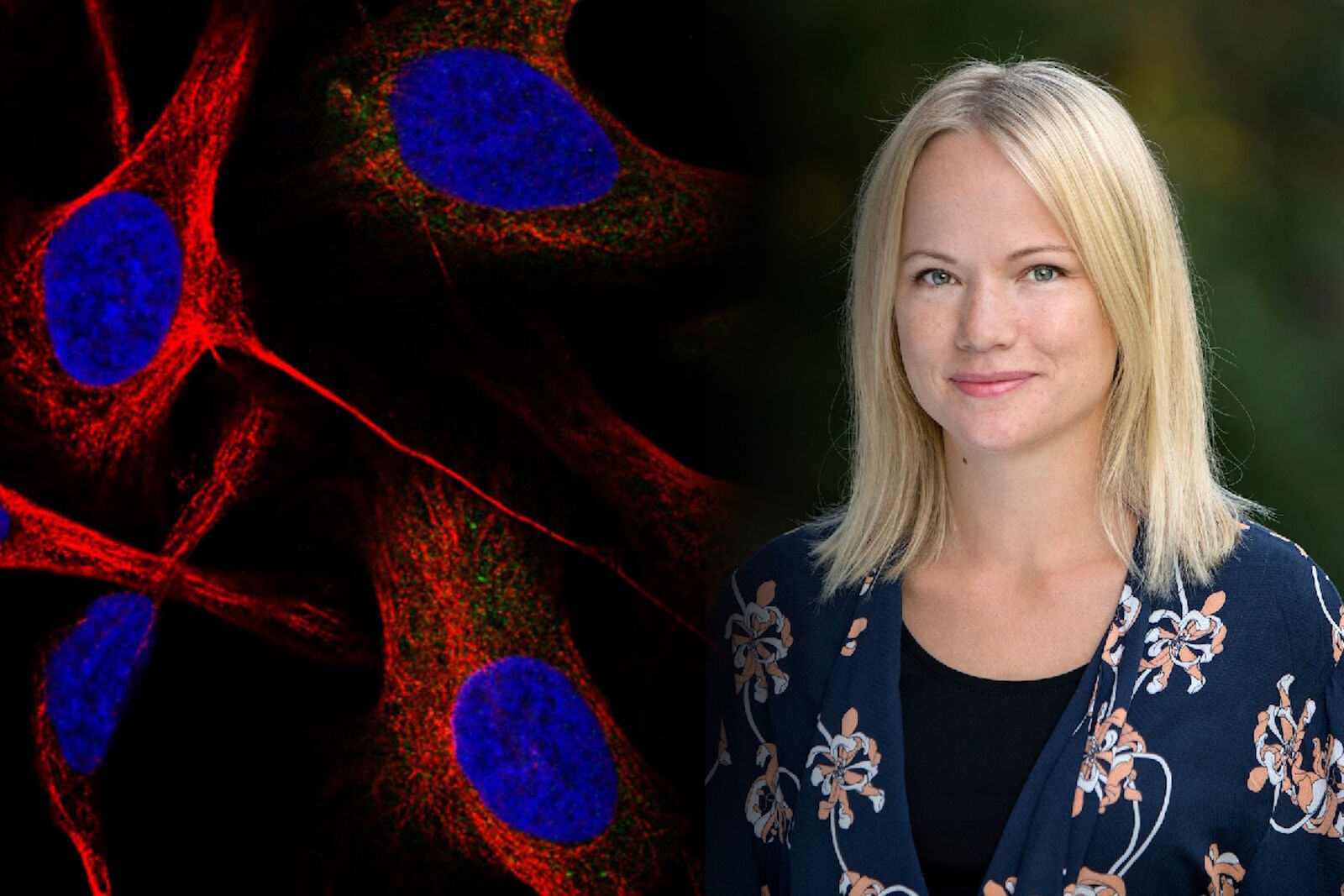 Applying AI and Machine Learning in Microscopy and Image Analysis