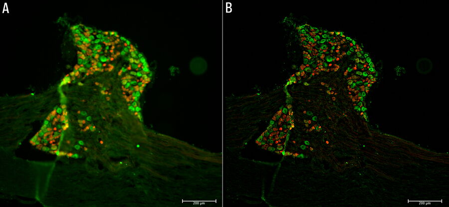 Raw widefield and THUNDER image of a mouse dorsal root ganglion with tdTomato (red) expressed in the sensory neurons.