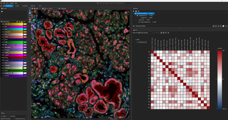 Aivia workspace showing multiplex image visualization, segmentation, and spatial analysis of human pancreas tissue.