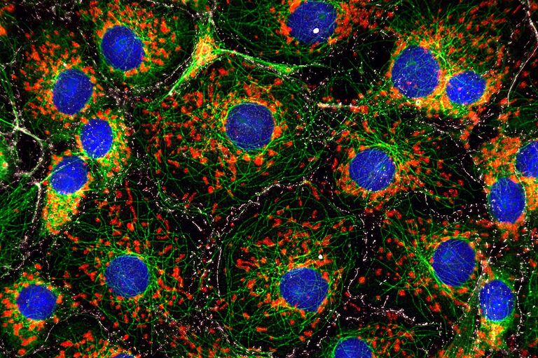 Ein mit THUNDER aufgenommenes Bild von COS-Zellen, die mit DAPI (blau), Mikrotubuli (grün), Mitochondrien (rot) und E-Cadherins (grau) gefärbt sind.