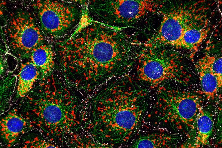 DAPI (青色)、微小管 (緑色)、ミトコンドリア (赤色)、E-カドヘリン (灰色) で染色したCOS細胞のTHUNDER画像。