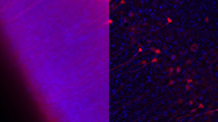 Influenca in lung epithelial cells (porcine) - THUNDER Imager 3D Cell Culture Influenca virus – red, cilia – green, Nuclei – blue. Influenca in lung epithelial cells (porcine) - THUNDER Imager 3D Cell Culture Influenca virus – red, cilia – green, Nuclei – blue.