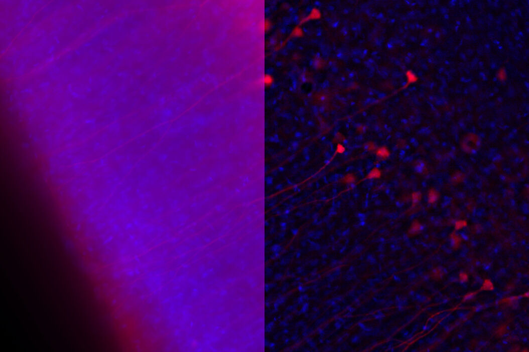 Influenca in lung epithelial cells (porcine) - THUNDER Imager 3D Cell Culture Influenca virus – red, cilia – green, Nuclei – blue. THUNDER-Imager-3D-Cell-culture_Rabies_brain_ferret_scaled.jpg