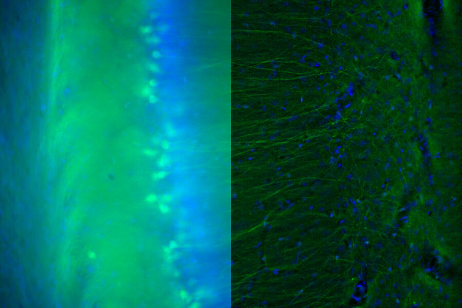 Brain Section - THUNDER Imager 3D Tissue