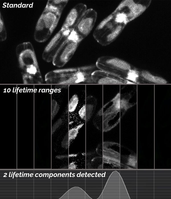 Diatoms examined with TauScan. 