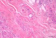 H&E stained specimen, 20x magnification 