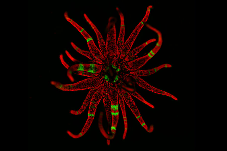 Sea anemone polyp (Exaiptasia pallida) - THUNDER Imager Model Organism