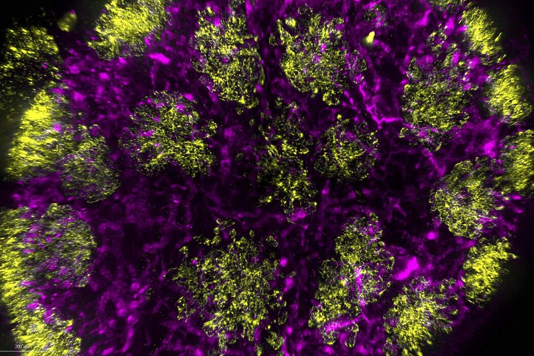 Mouse lymphnode acquired with a THUNDER Imager 3D Cell Culture. Image courtesy of Dr. Selina Keppler, Munich, Germany.  Mouse-lymphnode_THUNDER.jpg