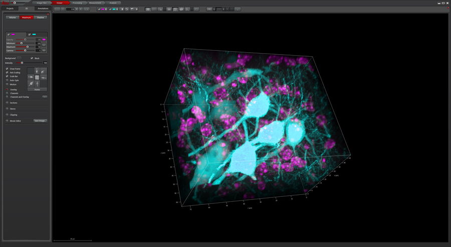 3D Reconstruction of brain slide image_Mica