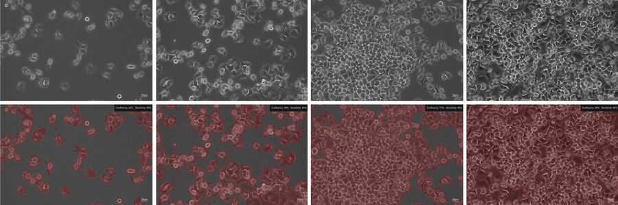 Example of a confluency check for HeLa cells: The top row shows phase-contrast images and the bottom row determination of cell confluency. The Mateo TL algorithm measures the percentage of the area covered by the cells.