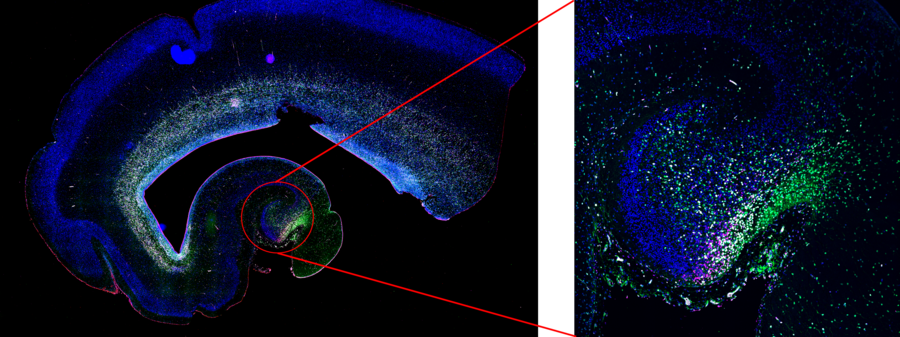 Several neural stem cells (green) can be found in a proliferative state, marked by Ki67 (gray) and/or MCM2 (magenta).