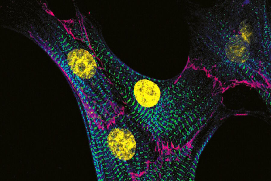 Neonatal cardiac myocyte (muscle cell)