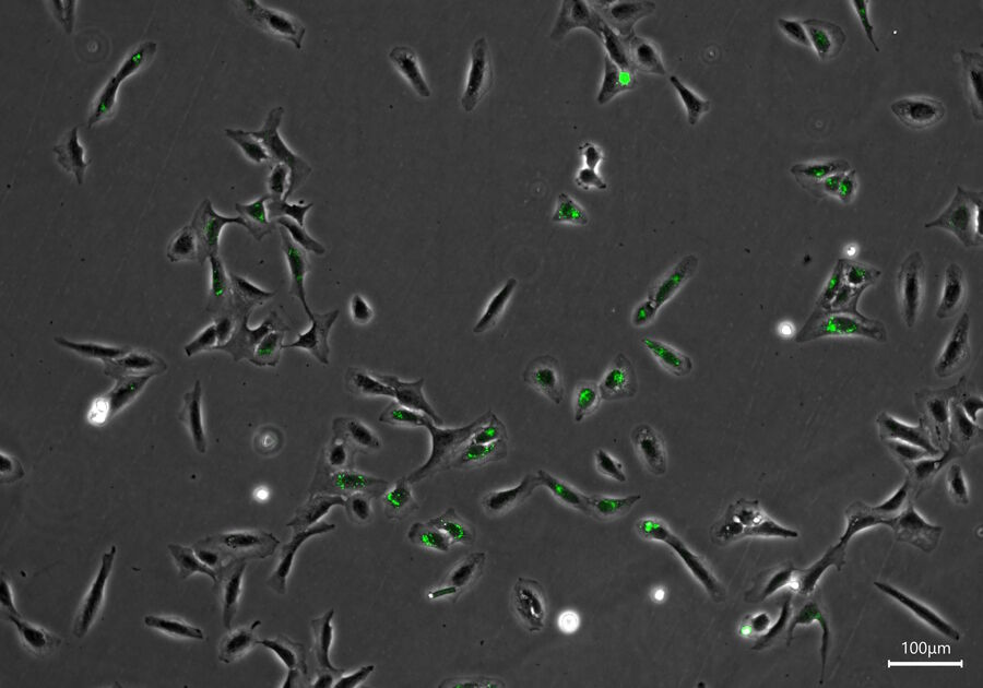 U2OS cells labelled with a green fluorescent marker
