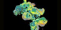 Organoid cluster labelled for nuclei (DAPI, blue) and plasma membrane (GFP, green). Thickness 100 μm. 469 Z planes were acquired using THUNDER Imager Cell (63x objective) and analyzed with Aivia. Courtesy of M.Sc. Dana Krauß, Medical University of Vienna, Austria.