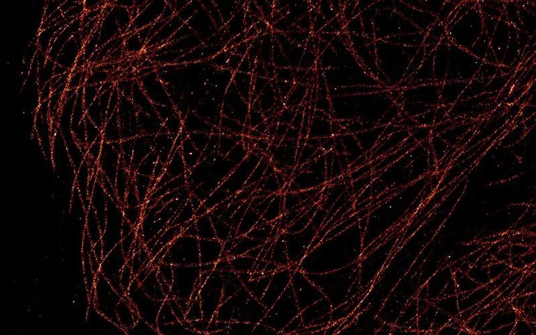 dSTORM-Bild von mit Alexa 647 gefärbten Mikrotubuli
