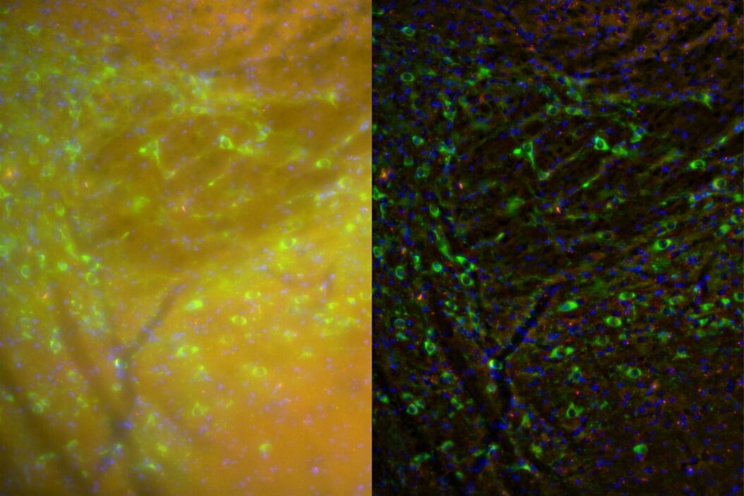 Raw widefield and THUNDER image of mouse brain showing D2-dopamine receptors.  Mouse_brain_showing_D2-dopamine_receptors_teaser.jpg