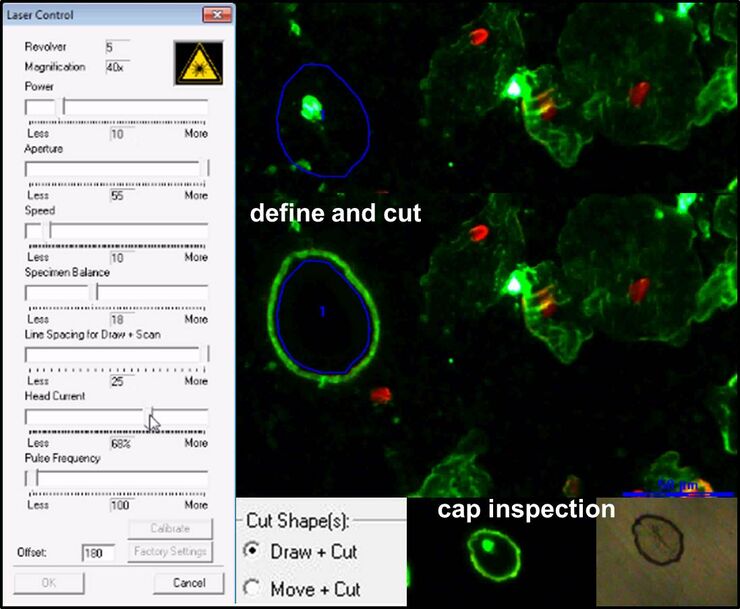 Volle Laserkontrolle zum Anpassen an jede Probe