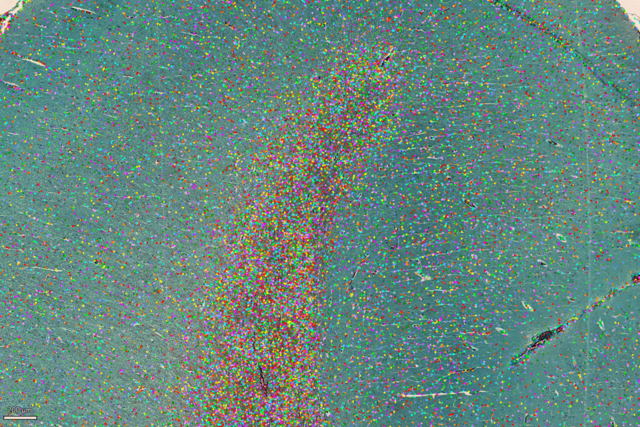 LAS X Navigator使用によるH&E染色した組織のタイリング画像 LAS X Navigator使用によるH&E染色した組織のタイリング画像