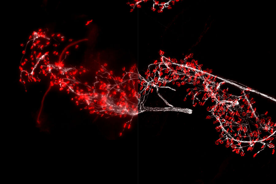 Neuromuscular junctions - THUNDER Imager 3D Tissue