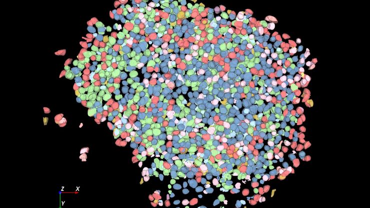 Large volume computational clearing processed Thunder image of human pancreatic islet organoid. Large volume computational clearing processed Thunder image of human pancreatic islet organoid. Cells segmented using Segment By Example tool, automatically phenotyped, and color-coded based on phenotypes in Aivia. Image courtesy of the Matthias von Herrath Lab, La Jolla Institute of Immunology, La Jolla, CA.