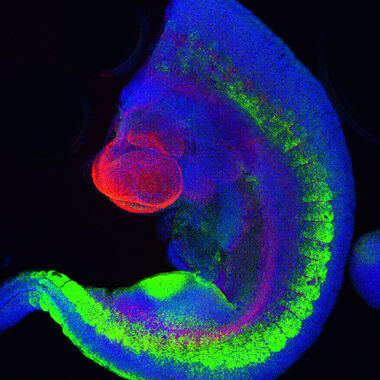 Mouse transgenic embryo, interlimb somites, Five interlimb somites of an E10.5 mouse transgenic embryo