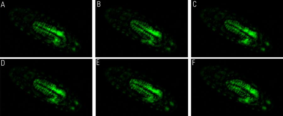 A time-lapse series of calcium transients in Drosophila embryo neurons where each image (A-F) indicates an average time interval of 10.5 seconds. The images were acquired with a THUNDER Imager and Computational Clearing. Courtesy of A. Carreira-Rosario, Clandinin laboratory, California, USA.