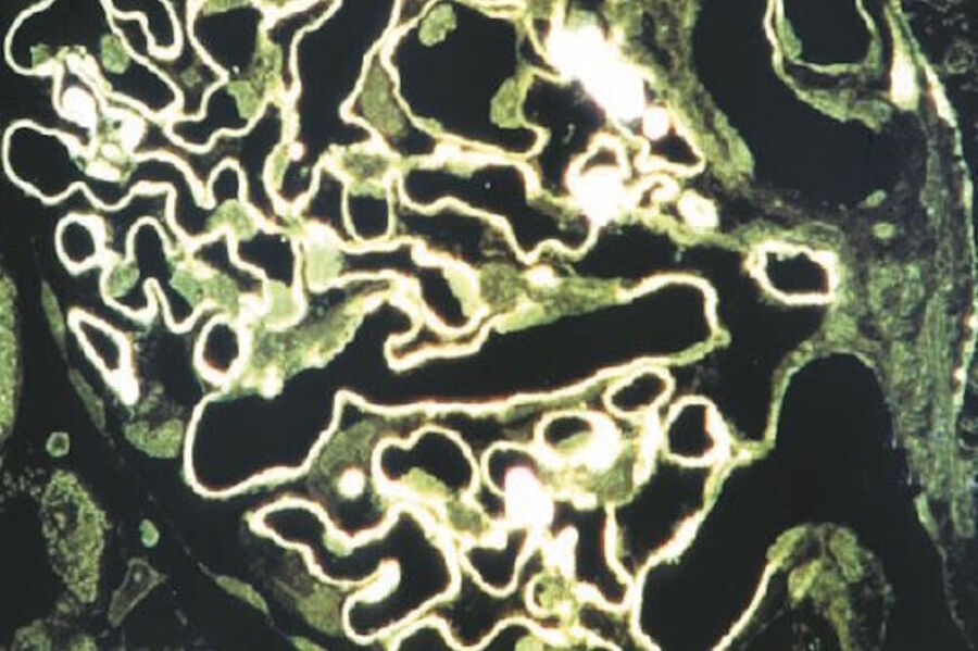 Ultrathin section (about 35 nm thick) of kidney tissue prepared with peroxidase DAB staining. Linear staining patterns of the glomerulus observed with reflection-contrast microscopy often result in sharper images than with fluorescence microscopy.