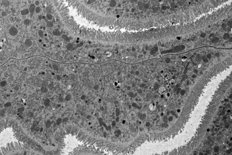 [Translate to portuquese:] Overview of Drosophila gastric caeca and a mitochondrion with well-defined cristae and well-preserved surrounding membranes. Micrographs courtesy of Dr. Syed (NIH/NIDCR) and Dr. Bleck (NIH/NHLBI)