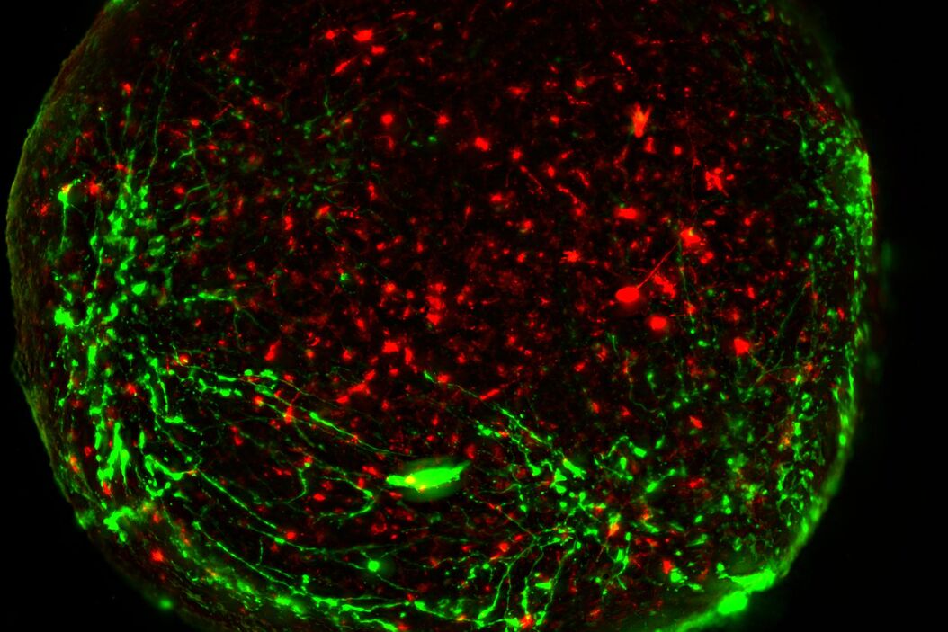 Virally labeled neurons (red) and astrocytes (green) in a cortical spheroid derived from human induced pluripotent stem cells. THUNDER Model Organism Imager with a 2x 0.15 NA objective at 3.4x zoom was used to produce this 425 µm Z-stack (26 positions), which is presented here as an Extended Depth of Field (EDoF) projection.  Images courtesy of Dr. Fikri Birey  from the Dr. Sergiu Pasca laboratory at Stanford University, 3165 Porter Dr., Palo Alto, CA Neural-sphere_model-org_LVC.jpg