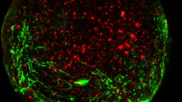 Virally labeled neurons (red) and astrocytes (green) in a cortical spheroid derived from human induced pluripotent stem cells. THUNDER Model Organism Imager with a 2x 0.15 NA objective at 3.4x zoom was used to produce this 425 µm Z-stack (26 positions), which is presented here as an Extended Depth of Field (EDoF) projection.  Images courtesy of Dr. Fikri Birey  from the Dr. Sergiu Pasca laboratory at Stanford University, 3165 Porter Dr., Palo Alto, CA