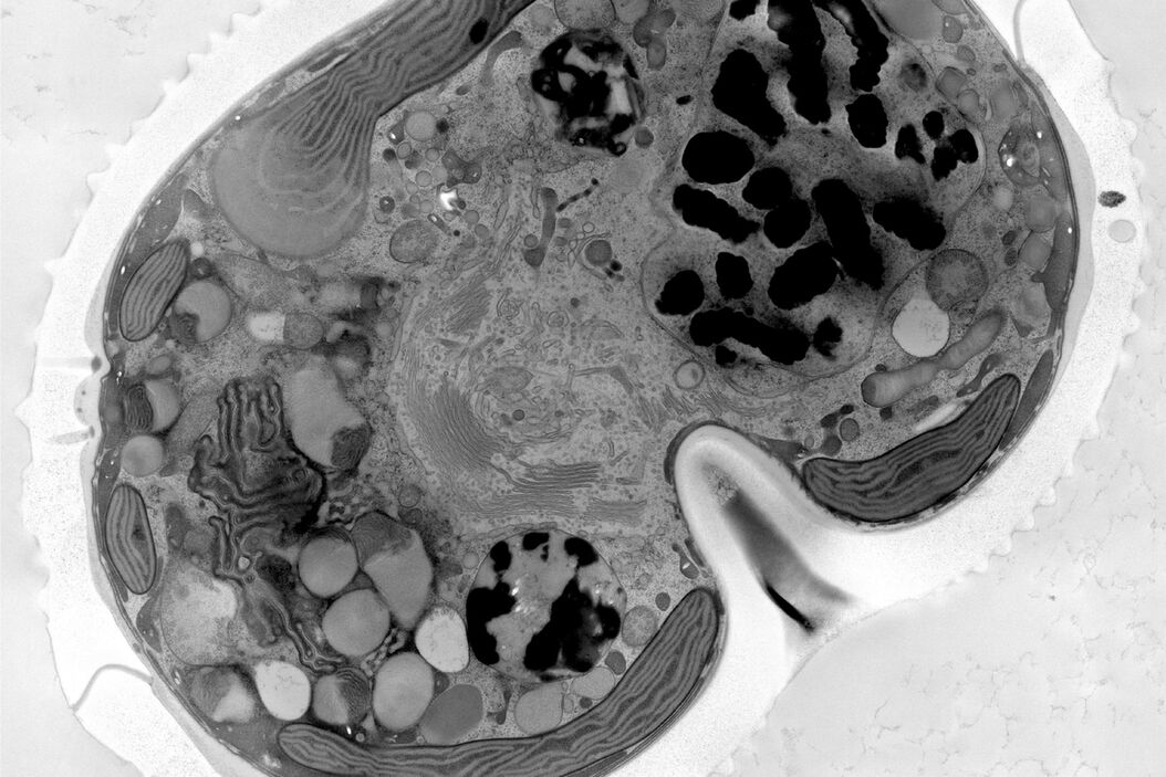 Micrograph of dinoflagellate cells. Scale bar = 1 µm.    Small_planktonic_cell.jpg