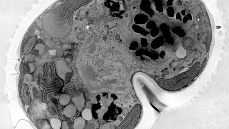 Micrograph of dinoflagellate cells. Scale bar = 1 µm. Micrograph of dinoflagellate cells. Scale bar = 1 µm.