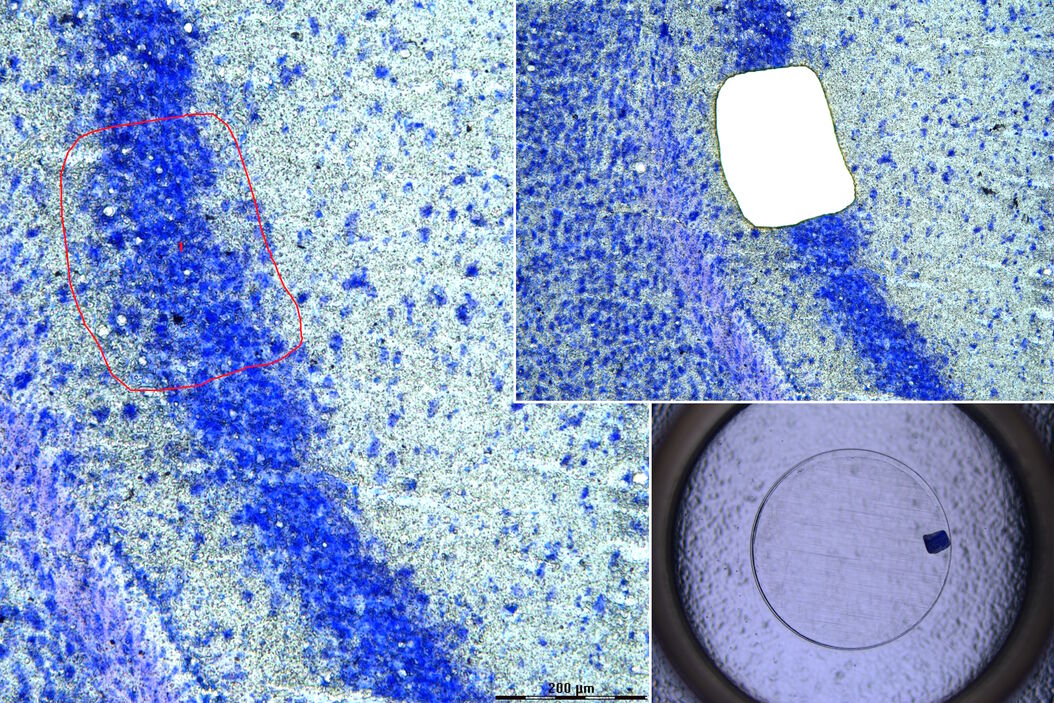 Mouse brain (left) microdissected with a 10x objective (upper right). Inspection of the collection device (lower right). Mouse_brain_microdissected_with_10x_objective.jpg