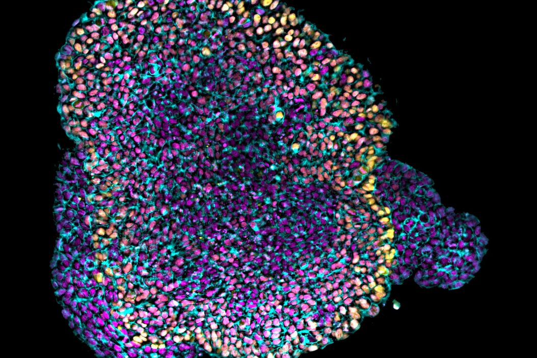 Single-plane image acquired 200 μm deep inside a cleared mouse gastruloid Single-plane-image-acquired-200-um-deep-inside-a-cleared-mouse-gastruloid.jpg