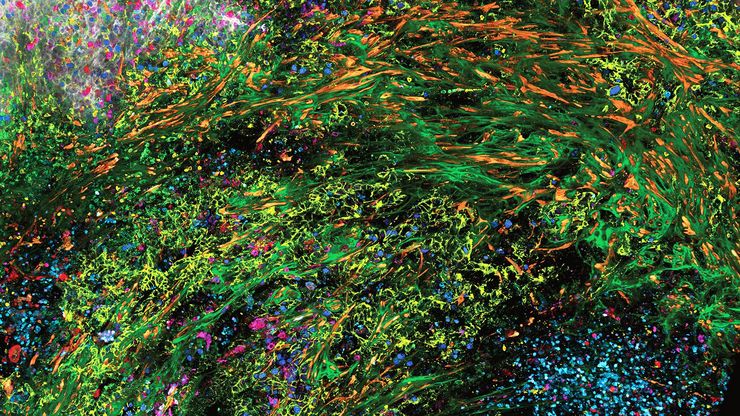 3D high-plex imaging in Cancer Immunology. Detail of a pancreatic tumor section in mouse model, labeled with 15 markers and imaged in one go using STELLARIS SpectraPlex. Total imaged volume 3.2 mm x 2.2 mm x 70 mm in 1 h 20 min. Source: 3D high-multiplex imaging in cancer immunology. Kunz L., Speziale D., et al., Nat. Methods (2024).