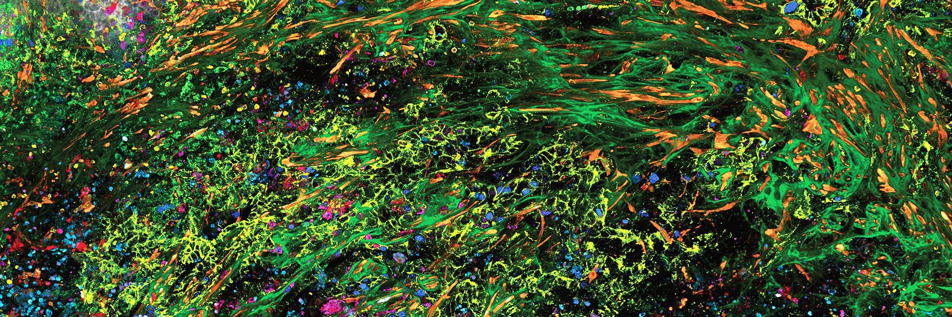 3D high-plex imaging in Cancer Immunology. Detail of a pancreatic tumor section in mouse model, labeled with 15 markers and imaged in one go using STELLARIS SpectraPlex. Total imaged volume 3.2 mm x 2.2 mm x 70 mm in 1 h 20 min. Source: 3D high-multiplex imaging in cancer immunology. Kunz L., Speziale D., et al., Nat. Methods (2024).
