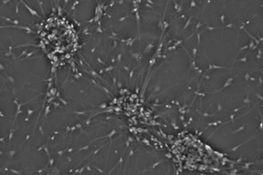 Primary neuronal cell culture.