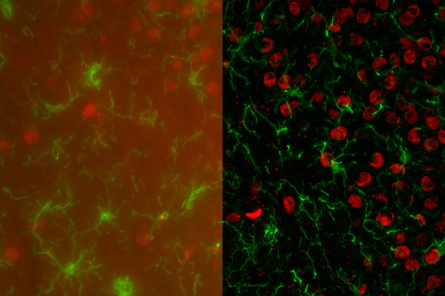These images show mouse brain expressing of AMPK (red) in Microglia (IBA-1+, green). The images were captured on a THUNDER Imager 3D Cell Culture with a 40x/1.30 oil objective. Both images represent maximum intensity projection of a z stack of 28 planes -total 27um thickness. The image on the left is the raw epifluorescence image, the right is the THUNDER-processed image with LVCC algorithm. Image courtesy of Dr. Maheedhar Kodali, Texas A&M University.