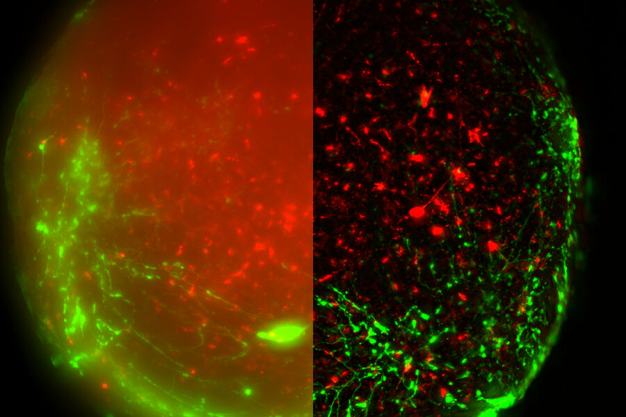 Virally labeled neuron - THUNDER Imager Model Organism