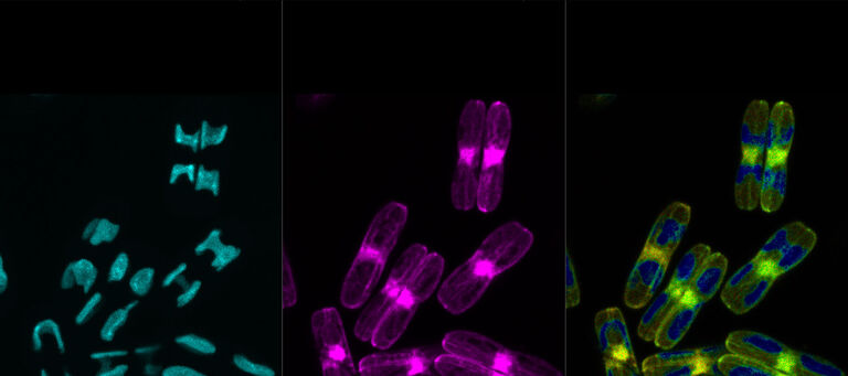 Diatomes examined with TauSense imaging tools. TauSeparation: Left image: Lifetime component 1 carving out the autofluorescence of the chloroplasts, average arrival time of the photons 1 ns. Center image: Lifetime component 2 revealing the clean LifeAct-GFP signal of actin filaments, 2.7 ns average arrival time. Right image showing TauContrast: The look-up-table indicates the arrival times by color: short arrivals times in blue, longer arrival times in yellow towards red.  Samples courtesy of Nicole Poulsen, B CUBE, TU Dresden, Germany.