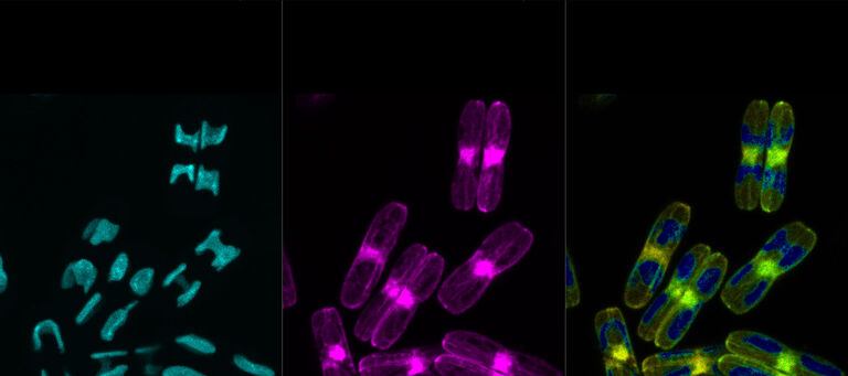 Diatomées examinées avec les outils d’imagerie TauSense. Image d’intensité de la bande spectrale 500-640nm. TauContrast - Tableau de correspondance indiquant le temps d’arrivée moyen des photons; temps d’arrivée courts en bleu, temps d’arrivée plus longs en jaune vers le rouge. Différentes structures sont révélées. TauSeparation - Deux composantes de durée de vie sont séparées, la composante 1 découpant l’autofluorescence du chloroplaste, 0,1ns; la composante 2 révélant le signal LifeAct-GFP propre, 2,7ns de temps d’arrivée moyen. Échantillons gracieusement offerts par Nicole Poulsen, B CUBE, TU Dresden, Allemagne.