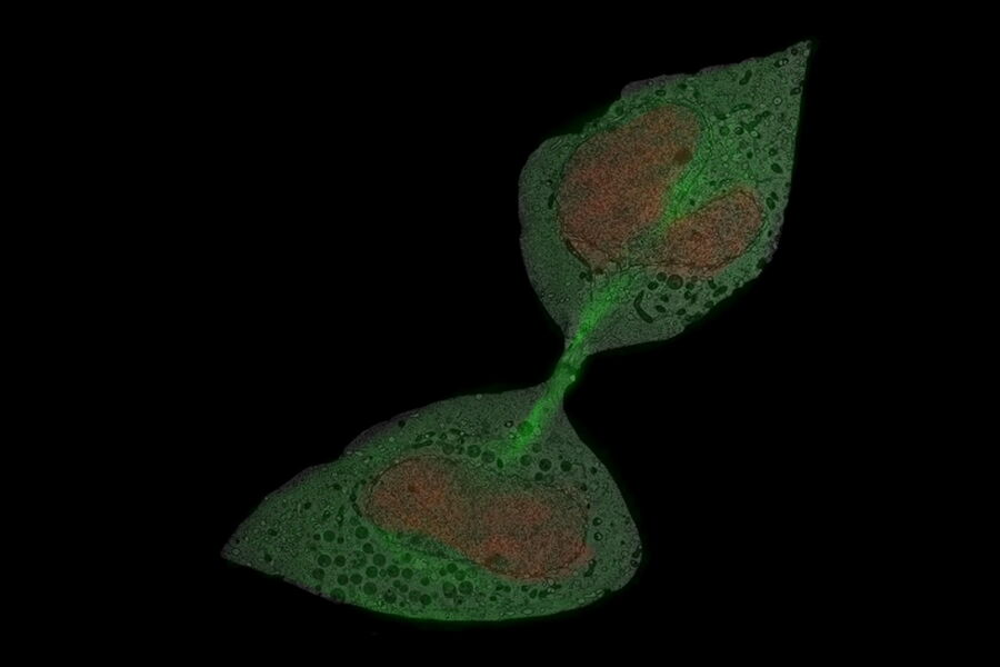 Image overlay of the light microscope and EM image.