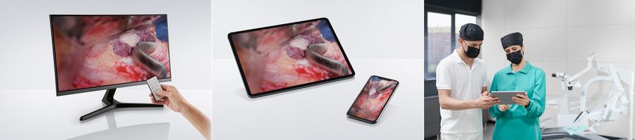 Store images and video in 4K quality conveniently on an SD card for easy transfer to a computer. Stream M320 microscope images to mobile devices via the Leica View App to share your expertise. The dental picture shows a sinus lift, image courtesy of Dr. Fabio Gorni, Milan, Italy