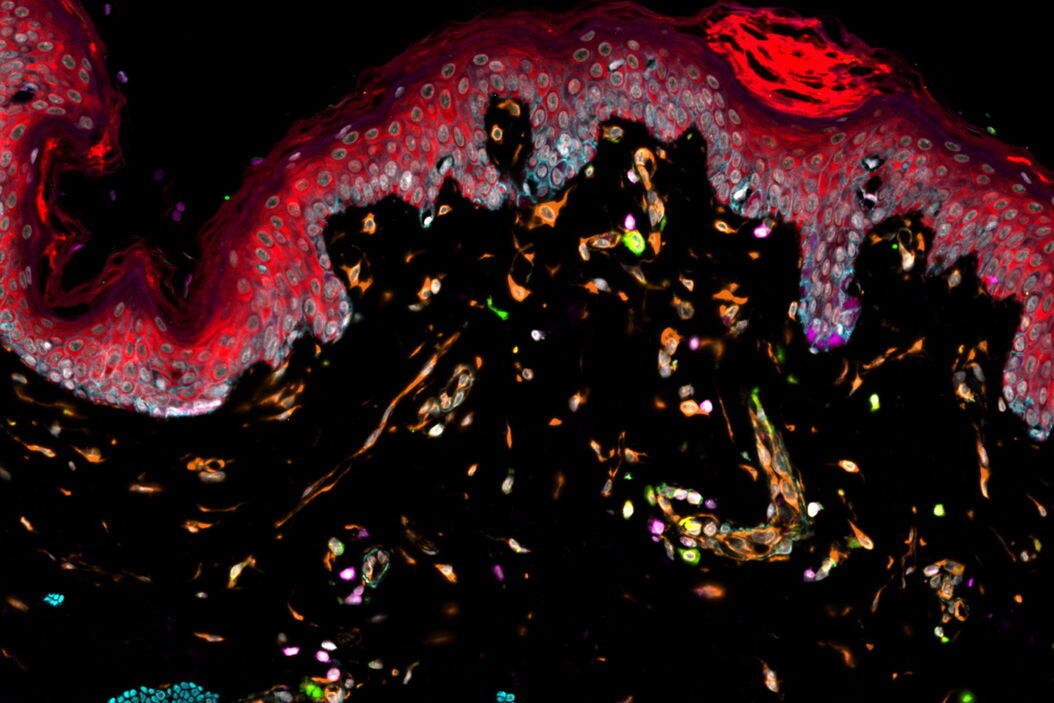 Normal skin imaged with Cell DIVE, 11 biomarkers shown. Skin_imaged_with_Cell_DIVE_11_biomarkers_shown.jpg