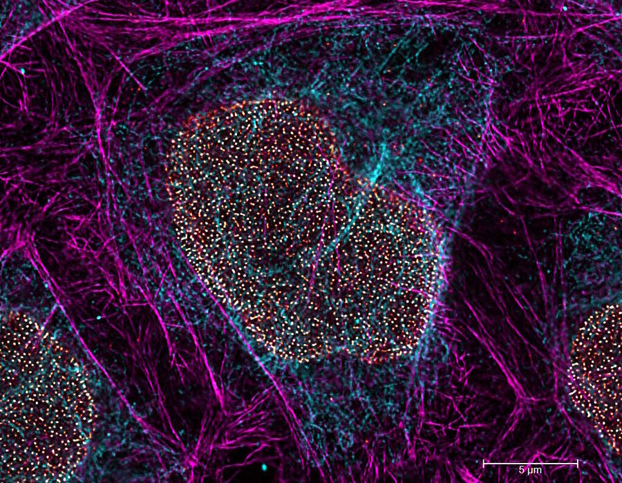 Figure 3: STED for Cell Biology: Multicolor fixed-sample TauSTED Xtend 775; Vimentin AF 594 (cyan), Phalloidin ATTO 647N (magenta) and NUP107 CF680R (glow). Triple color STED imaging with a single depletion line at low STED power. Sample courtesy of Brigitte Bergner, Mariano Gonzales Pisfil, Steffen Dietzel, Core Facility Bioimaging, Biomedical Center, Ludwig-Maximilians-University, Munich, Germany.