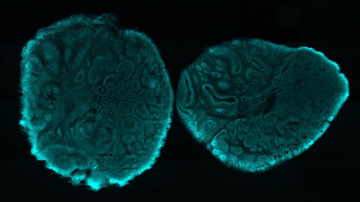 Brain organoid section (DAPI) acquired using THUNDER Imager Live Cell. Image courtesy of Janina Kaspar and Irene Santisteban, Schäfer Lab, TUM.