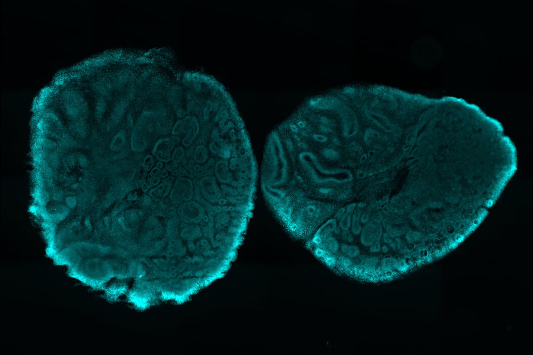 Brain organoid section (DAPI) acquired using THUNDER Imager Live Cell. Image courtesy of Janina Kaspar and Irene Santisteban, Schäfer Lab, TUM. Tilescan_of_brain_organoid_section.jpg