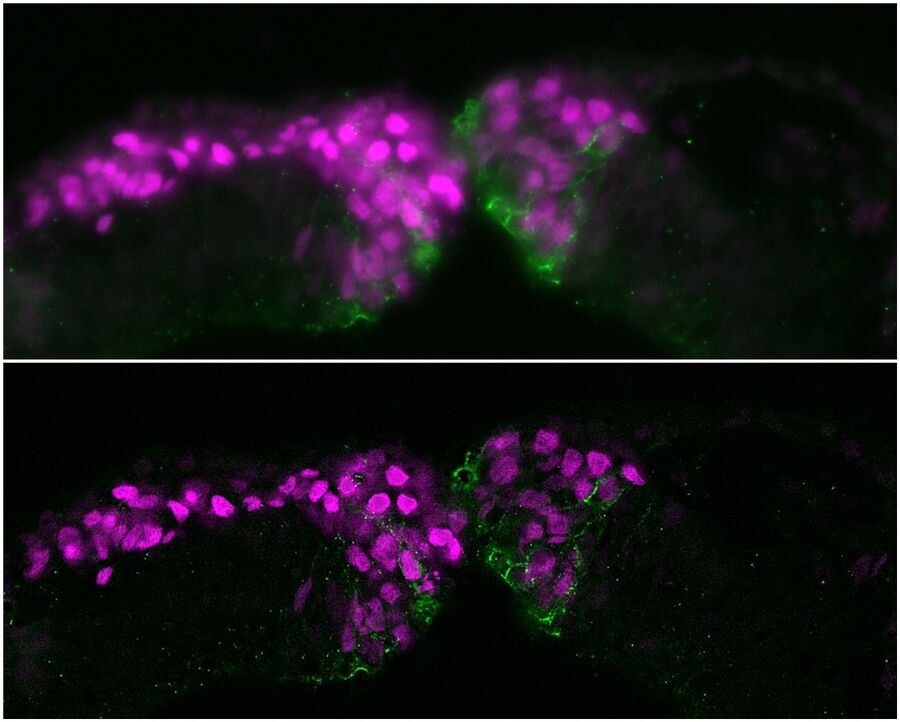 Neural crest (NC) embryonic cell population - THUNDER Imager 3D Cell Culture