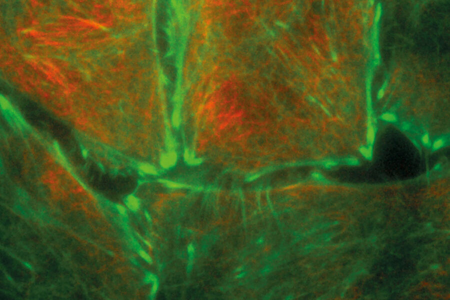 Células Hela que expresan de forma estable el marcador cromocuerpo actina GFP2 y teñidas con SIR-Tubulina. Cortesía de ChromoTek GmbH, Múnich, Alemania, y Spirochrome SA.