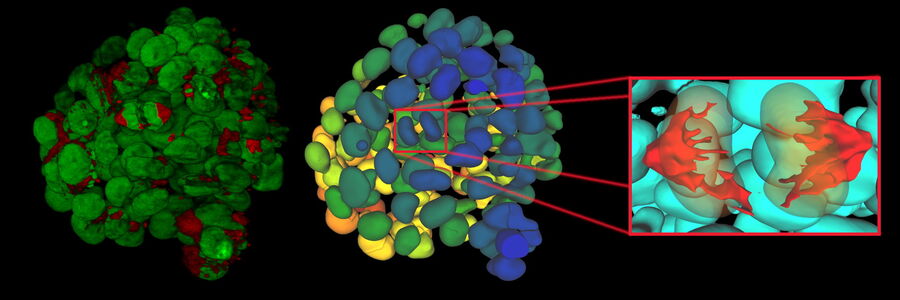 Single timepoint of a time-lapse recording of mammary epithelial micro spheroid cultured in 3D highlighting individual mitotic events Single timepoint of a time-lapse recording of mammary epithelial micro spheroid cultured in 3D highlighting individual mitotic events